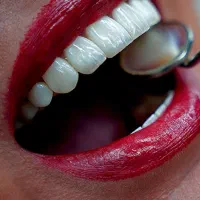 جشنواره پاییزه کامپوزیت،لمینیت،ایمپلنت اقساط|خدمات آرایشگری و زیبایی|بومهن, |دیوار