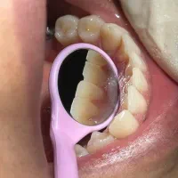ایمپلنت با تعرفه دولتی|خدمات زیبایی و سلامت|تهران, بلوار کشاورز|دیوار
