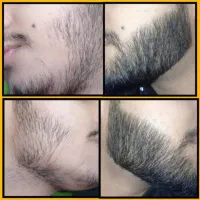 پک رویش ریش