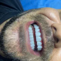 آموزش تخصصی کامپوزیت دندان با برد تخصصی|خدمات آموزشی|اندیشه, شهرک کوثر|دیوار