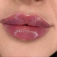 پزشک نخ لیفت مزو کلاژن آنزیم ژل بوتاکس فیلر prp|خدمات زیبایی و سلامت|کرج, گوهردشت|دیوار