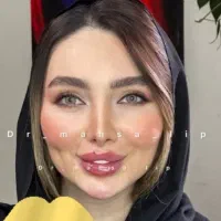 فیلربینی بوتاکس نخ ابرو لب روسیMزاویه ژل گونه پزشک