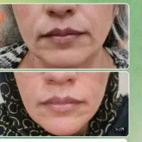 کرم پاور لیفتینگ بیوممتیک