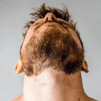 ریموو تاتو/ریزش سکه ای/مزوتراپی/خال برداری/فیشیال|خدمات آرایشگری و زیبایی|شیراز, شاهجیان|دیوار