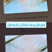 پاکسازی تخصصی کف سر + آنالیز رایگان +تخفیف بینظیر|خدمات آرایشگری و زیبایی|رودهن, |دیوار