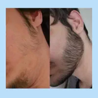جذابیت مردونه دیگه رویا نیست