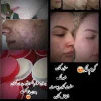 کرم سفید کننده صورت