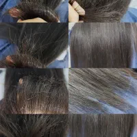 موخوره گیری به روش روسی تخفیف شب یلدا|خدمات آرایشگری و زیبایی|نجف‌آباد, بازار|دیوار