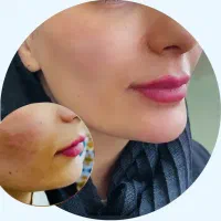 ژل،بوتاکس،پی آرپی،میکرونیدلینگ|خدمات آرایشگری و زیبایی|اصفهان, خانه اصفهان|دیوار