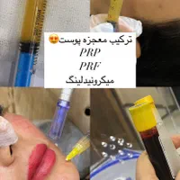 درمان ریزش مو جوانسازی پوست با پی آر پی ومزوژل|خدمات آرایشگری و زیبایی|اصفهان, ملک‌شهر|دیوار