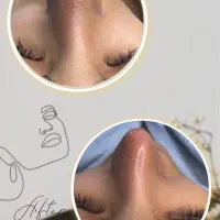 تخفیف فیشیال کلاسیک(رفع جوش سرسیاه)|خدمات آرایشگری و زیبایی|دوگنبدان, |دیوار