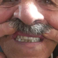 ساخت عنواع دندان مصنوعی ایرانی وخارجی|خدمات آرایشگری و زیبایی|آشخانه, |دیوار