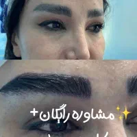 تکنسین خانم حرفه ایی کاشت مو و ابرو (شهرستان)