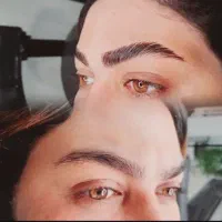 لیفت ابرو و مژه