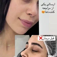 درمان مشکلات پوستی|خدمات آرایشگری و زیبایی|شاهین دژ, |دیوار