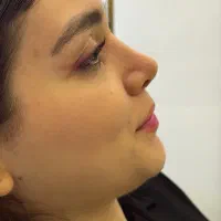 جراحی بینی کلینیک دکتر احسانی|خدمات زیبایی و سلامت|تهران, مرزداران|دیوار