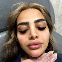 افتتاح کلینیک زیبایی بیمارستان فرهنگیان بوتاکس 550