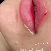ژل وبوتاکس|خدمات آرایشگری و زیبایی|اهواز, کمپلو شمالی|دیوار