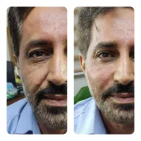 تخفیف پاییزی ژل و بوتاکس نتایج طبیعی و حرفه ای|خدمات آرایشگری و زیبایی|تهران, میرداماد|دیوار