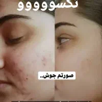 لاغری واصلاح مزاج بصورت ۱۰۰درصدتضمینی|آرایشی، بهداشتی، درمانی|اهواز, بهارستان|دیوار