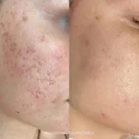 تخفیفات ۵۰٪ ،پاکسازی صورت،لیفت ابرو،بافت مو|خدمات آرایشگری و زیبایی|پاکدشت, پاکدشت (مامازند)|دیوار