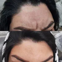 فیشیال مردانه تخصصی + بوتاکس و مزوتراپی|خدمات آرایشگری و زیبایی|رفسنجان, |دیوار