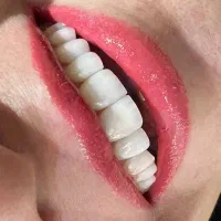 تخفیف ویژه ۲۰٪خدمات دندانپزشکی|خدمات آرایشگری و زیبایی|شیراز, ارم|دیوار