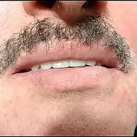 دندان کامل(شرایطی ویژه)|خدمات آرایشگری و زیبایی|سلطانیه, |دیوار