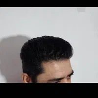 مرکزتخصصی کاشت مو|خدمات آرایشگری و زیبایی|شیراز, ارم|دیوار
