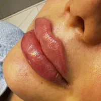 تخفیف ویژه پاکسازی صورت ویژه آقایان و خانم ها|خدمات آرایشگری و زیبایی|اهواز, سپیدار|دیوار