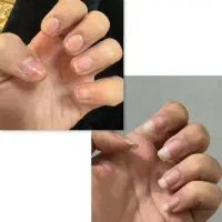 تقویتی ناخن فرانسه