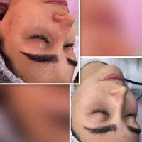 آموزش تخصصی فیشیال با مدرک فنی و حرفه ای