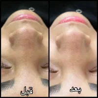 پاکسازی پوست