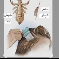 محلول گیاهی درمان شپش و رشک  با جواب دهی صد درصد