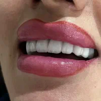 دنداپزشکی با شرایط