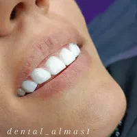 آموزش کامپوزیت دندان ،بیلیچینگ ،لمیمنت روکش دندان|خدمات آرایشگری و زیبایی|کرج, چهارصد دستگاه|دیوار