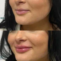 کلینیک تخصصی اریکا (لیزر و پوست و‌ مو )