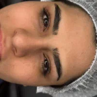 فیبروز میکروبلدینگ
