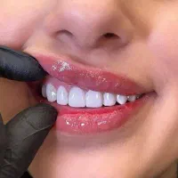 کامپوزیت دندان|خدمات آرایشگری و زیبایی|اردبیل, |دیوار