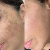 خدمات فیشال حرفه ای