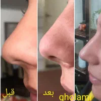 کلینیک و سالن زیبایی گیسو بانو|خدمات آرایشگری و زیبایی|اصفهان, خانه اصفهان|دیوار