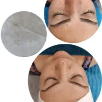 فیشیال پوست|خدمات آرایشگری و زیبایی|فلاورجان, |دیوار