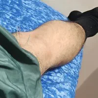 کمک برای سیاتیک