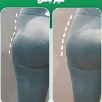 فیلربادی باسن لب زیرچشم... نخ لیفت امبدینگ-اقساطی