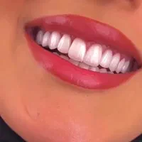 دندانسازی دندان سازی دندان مصنوعی پروتز|خدمات آرایشگری و زیبایی|مشهد, ولیعصر (شهرک غرب)|دیوار