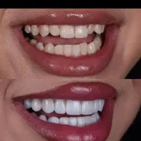 سلامت وزیبایی دندان