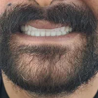 دندانسازی تخصصی|خدمات آرایشگری و زیبایی|بهبهان, |دیوار