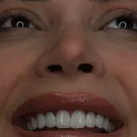 جشنواره لبخند /دنتال الماس