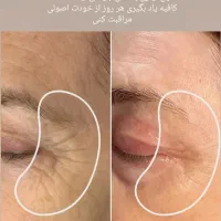 پوستت لایق یه تغییر خاصه|خدمات آرایشگری و زیبایی|شاندیز, |دیوار