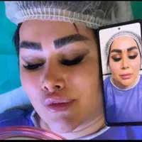 جشنواره تابستان عمل زیبایی|خدمات آرایشگری و زیبایی|قم, باجک دو|دیوار